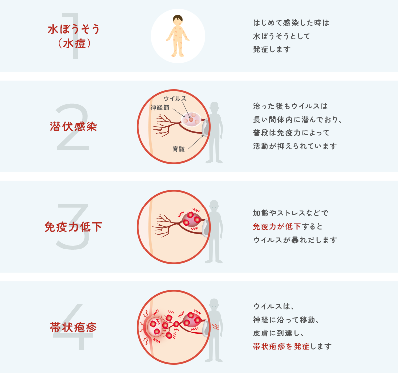 ハイヒール・モモコも苦しんだ帯状疱疹「髪の毛が触れても痛い！」恐るべき5072問題1 1介護ポストセブン