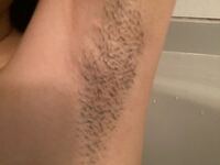 脇の黒ずみについて質問です。女性の回答だと参考になります。 -- Yahoo!知恵袋