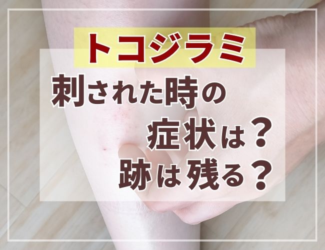 南京虫 ベッドバグ・トコジラミ を防ぐ対策方法兎家 うさぎや Hotel & Guesthouse ホーチミンの日本人宿 ～Usagiyah～