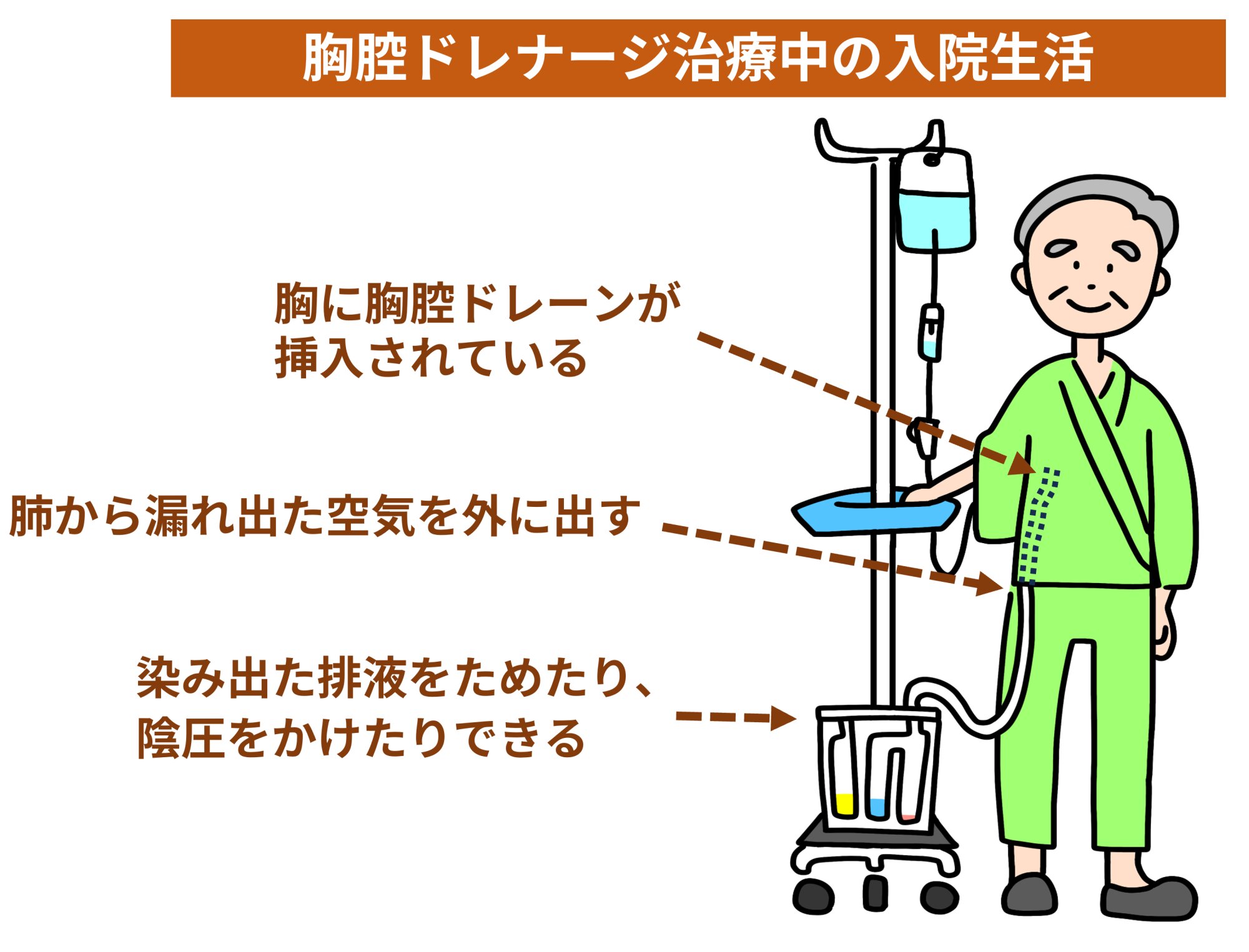 胸腔ドレナージのイラスト - 医療のイラスト・写真・動画、素材販売サイトのメディック medick