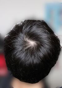 男子高校生です。 - つむじハゲてませんか？ - Yahoo!知恵袋