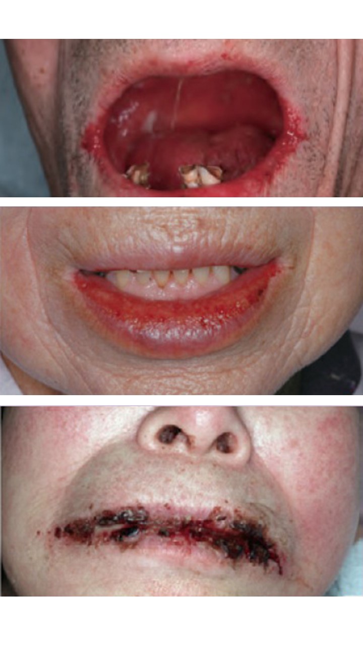 口腔粘膜疾患口腔外科相談室日本口腔外科学会