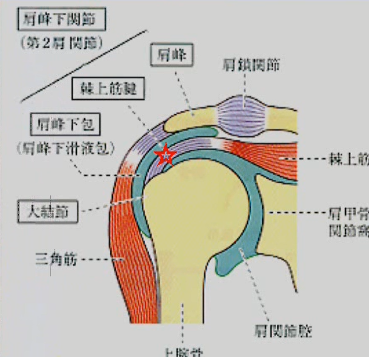棘上靭帯炎 - 倉敷市ジール鍼灸整骨院 整体院