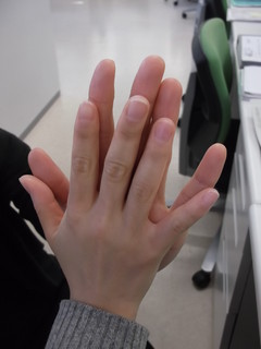 写真 IU、コンプレックスを告白！？「小さい手のせいで顔が大きく見える」 1 2 韓流スターズ