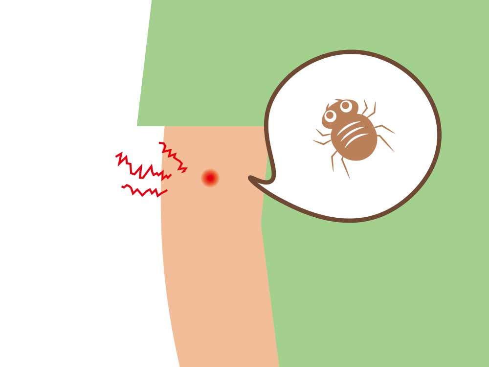 無視してはいけない虫刺され14選 症状別の画像で確認