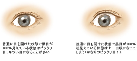 眼瞼下垂手術をして、まぶたが開き過ぎてビックリ目や上三白眼やキツい目になることはあるのか？ ： Dr.高須幹弥の美容整形講座：美容外科 高須クリニック