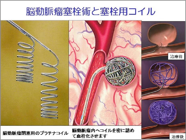 ポリ袋にエンボス加工をするメリットってなに？ポリ袋・ゴミ袋のサニパック