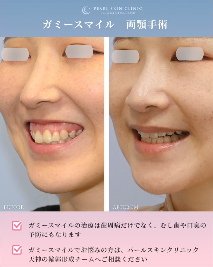 人よりアゴが長い”をどうとらえる？ 好きになる方法を模索する女性＆武器に変えた男性 さまざまな容姿への価値観オリコンニュース ORICONNEWS