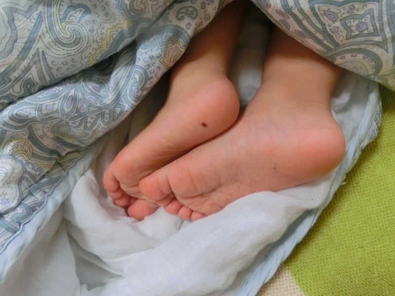 ほくろと間違いやすい「がん」特徴や見分け方は？ 専門家に聞いた：東京新聞デジタル