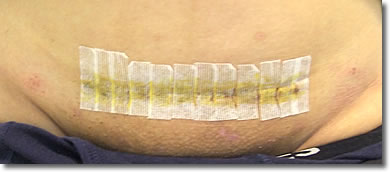 子宮摘出をする理由とは？病気や悩み、術式や術後など、幅広く解説東京・ミネルバクリニック