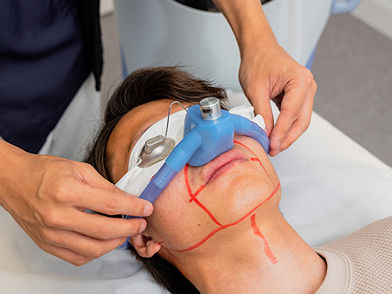 メンズ 眉毛脱毛のおすすめランキング5選！男の印象は眉毛で決まる？脱毛の費用相場とレーザー脱毛で失敗しないポイントMOTEO