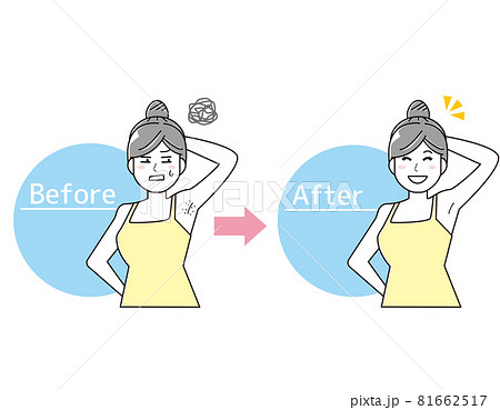 40歳・女性YouTuber「18年間、脇毛を処理していない」→“処理しない理由”語る 「脇のみならず」 1 2エンタメ ねとらぼ