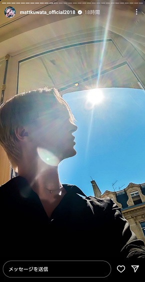 Matt マット桑田 が整形か画像比較注目は「おでこ」「目」「鼻」「顎」