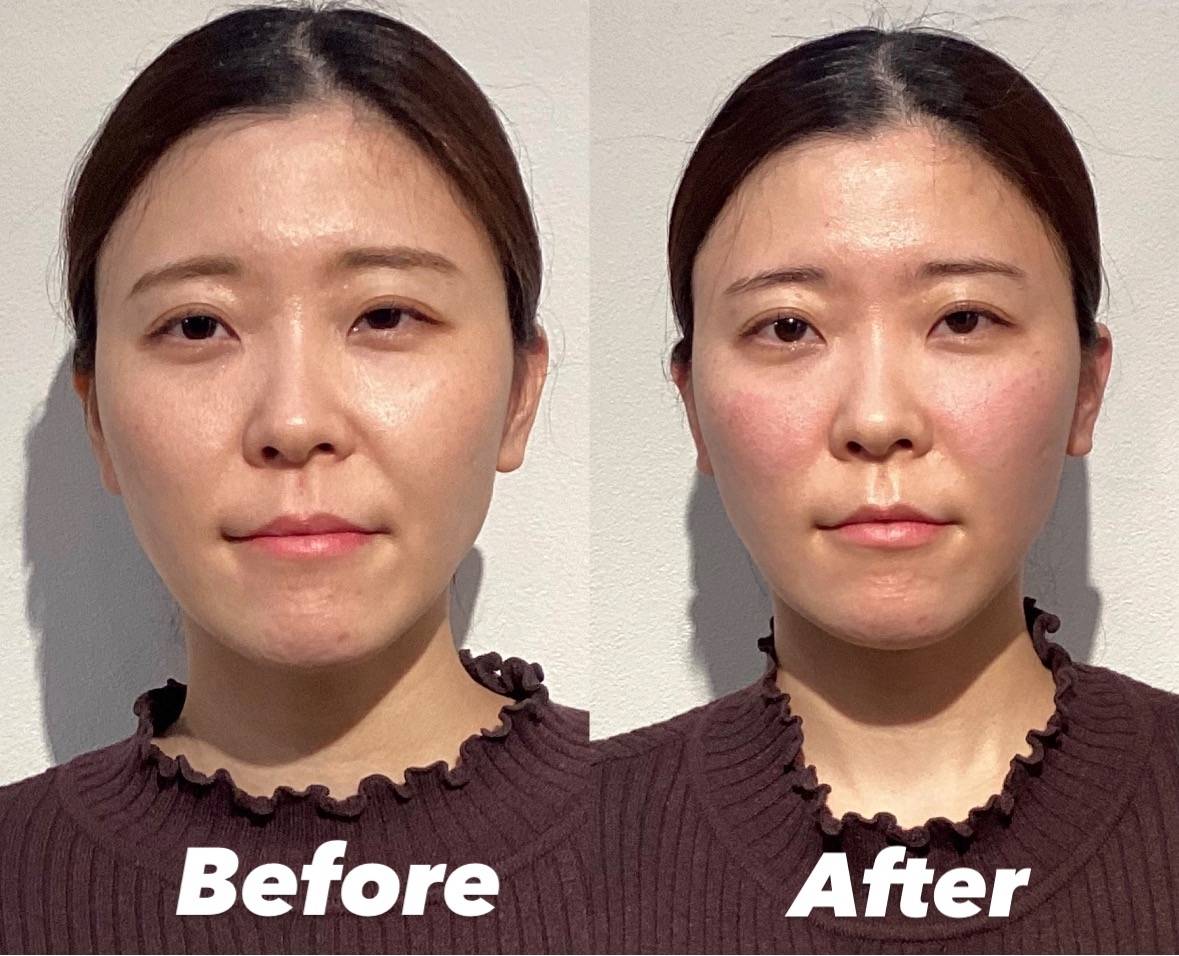 そのぶくぶくうがい、大丈夫? ②SawakoGoto