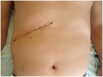 八雲総合病院 - 手術写真