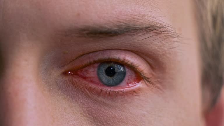 目の病気宗像眼科