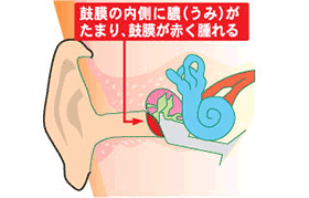 蜂窩織炎症野田市 小児科 千葉県 こどもの花粉症 こどもの漢方 喘息 アトピー性皮膚炎 アレルギー 結節性痒疹 たんぽぽこどもクリニック
