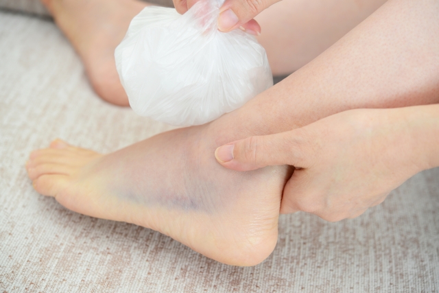 なぜ？紫のあざが消えない 「身に覚えのないあざ」は要注意！病院は何科？Medicalook メディカルック