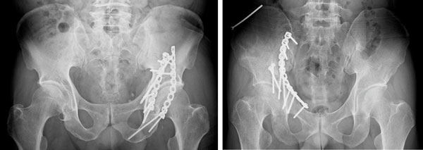 レントゲンの重要性柏市のカイロプラクティック専門院 病院と提携 「宮田カイロプラクティック」