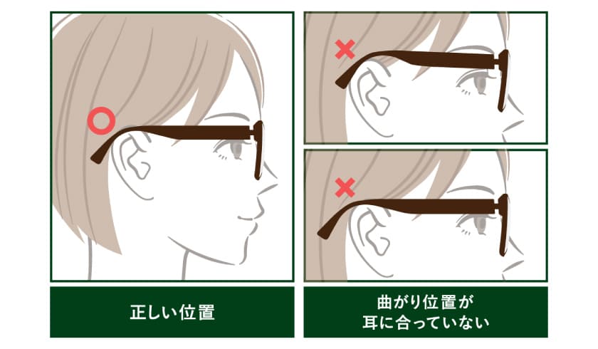 それってメガネ跡・！？気になる色素沈着 シミ を防止して、キレイに消す3つの方法