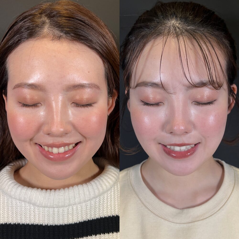 あご下の肉をなくしたい 原因と解消法！ すっきりフェイスラインを手に入れるOggi.jp