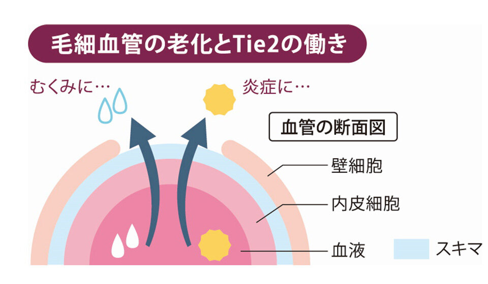 脳梗塞予防に効果あり？ルイボスティーの驚くべき健康効果とは - 脳梗塞・脊髄損傷クリニック