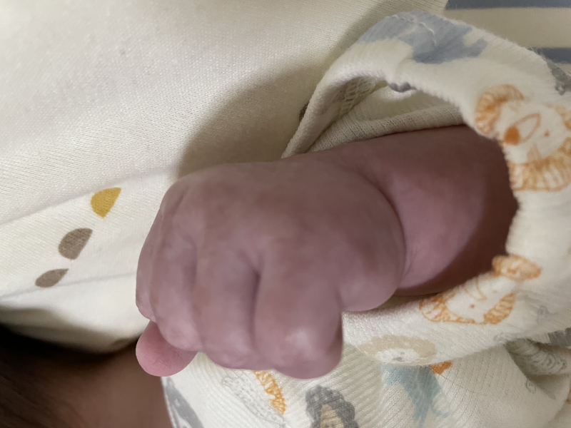 赤ちゃん 色白 病気TikTok