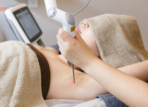 脇 ワキ のブツブツは黒ずみの前兆？ブツブツ毛穴をなくして、きれいな脇を目指しませんか美容皮膚科 銀座よしえクリニック 公式 東京