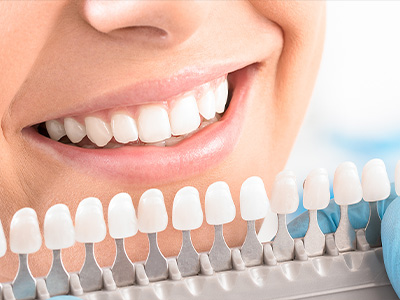 前歯を含む複数歯のセラミック治療 医 精密審美会