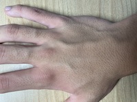 手の毛穴をなくす方法とおすすめスクラブ