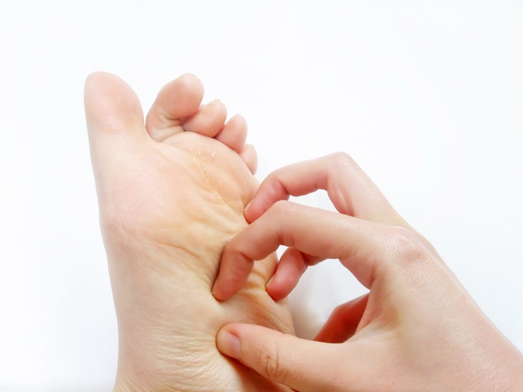 入院患者にしばしば起こる足の落屑：日経メディカル