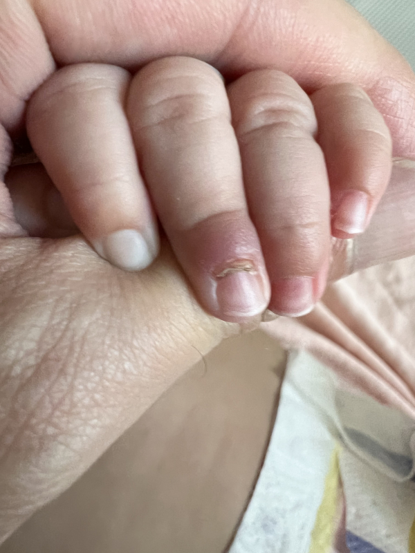 アトピタ 薬用保湿入浴剤 粉末 新生児～ スキンケア ベビーイオンスタイルオンライン 衣料品・暮らしの品をネットでお買物