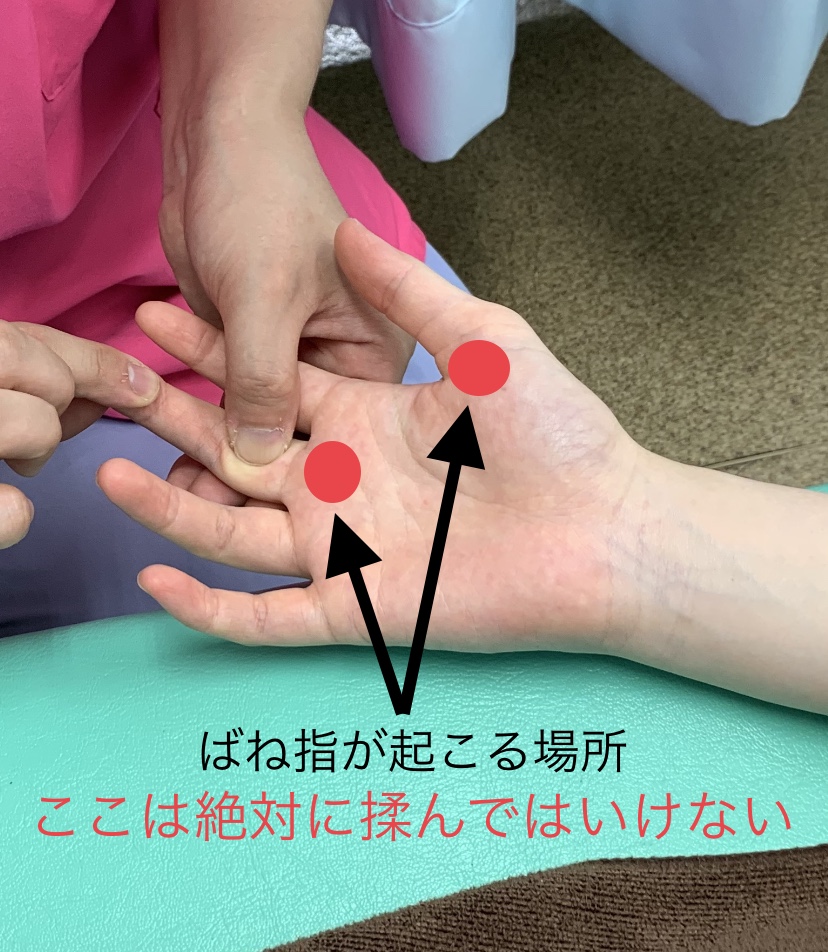 写真で分かるリウマチ集 ～指のリウマチ～さとう埼玉リウマチクリニック 大宮院 さいたま市のリウマチ専門のクリニック