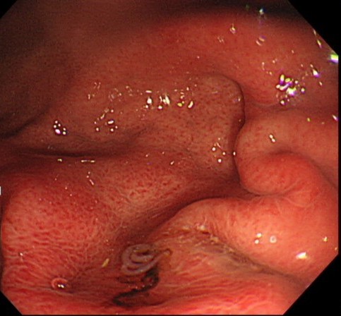 鉤虫 －十二指腸虫の生態－桜映画社
