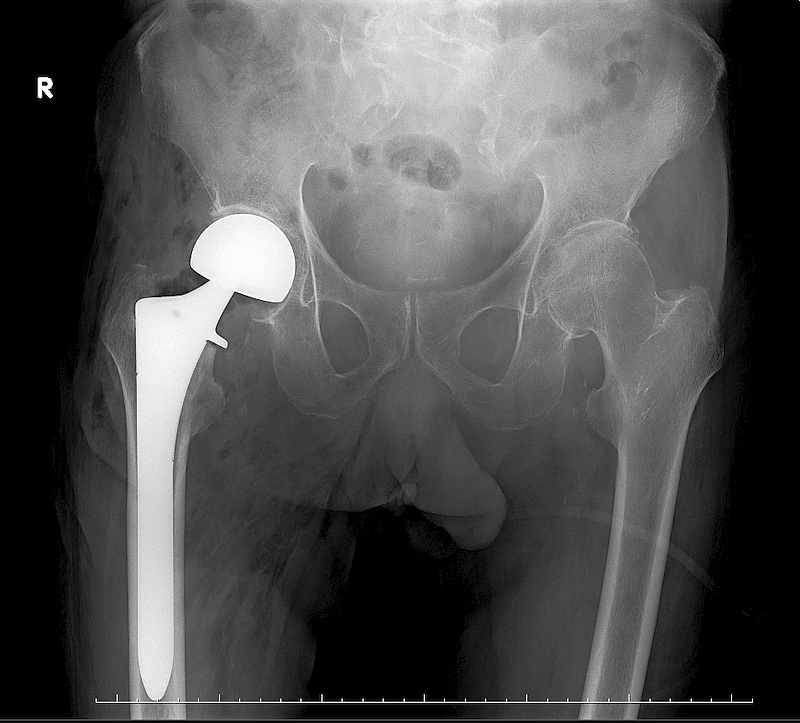 エックス線一般撮影亀田グループサイト