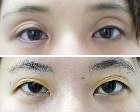 まぶたに目イラスト無料イラスト・フリー素材なら「イラストAC」