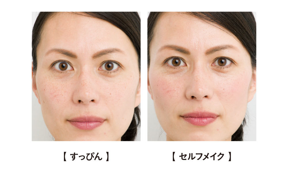 急に増えたシミの原因とは？良性と悪性の見分け方を徹底解説 - 東京・大阪の美容皮膚科ならFLALU フラルクリニック