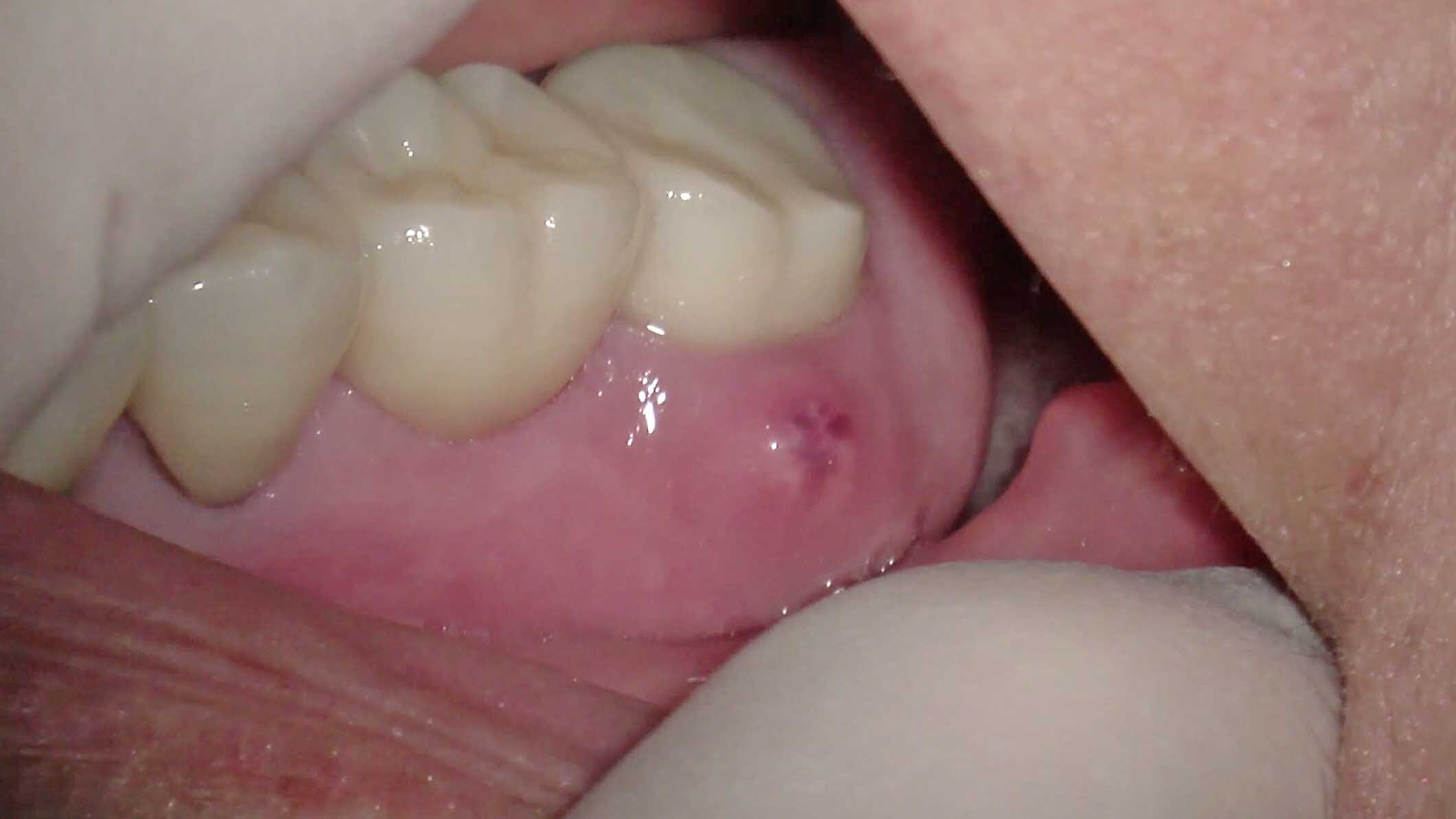 猫の歯槽膿漏の症状と原因、治療法についてペット保険のPS保険