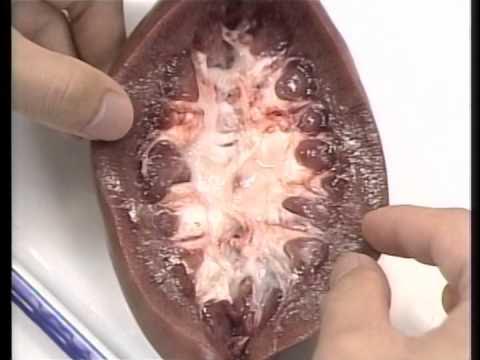 Amazon.co.jp: 等身大3個セット 腎臓・尿路系モデル 副腎皮質ネフロンモデル 糸球体腎臓解剖モデル 腎臓断面図 : 産業・研究開発用品