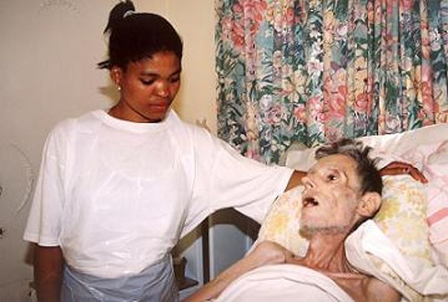 HIV感染者の平均余命、今では一般とほぼ変わらず＝英研究 - BBCニュース