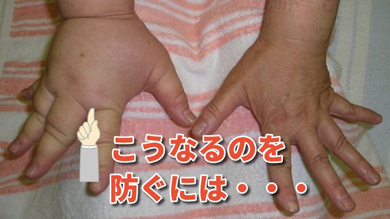 セルフお灸 顔のむくみをとる 合谷のツボ セルフお灸のやり方Self-moxibustion for improving facialswelling YI’N YANG美容鍼・鍼灸治療院