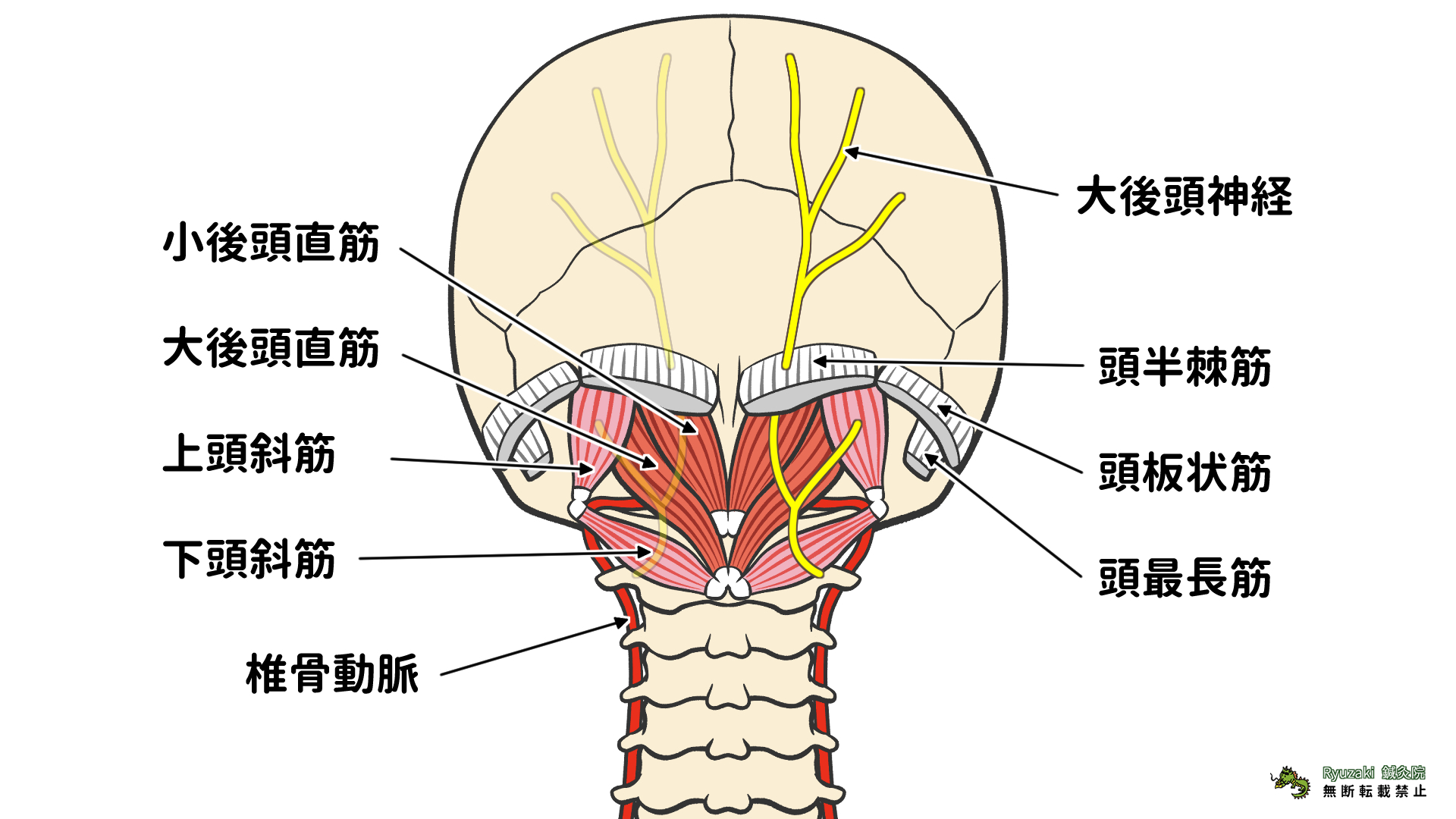 後頭下筋からの頭痛岡崎市の整体 稲垣カイロプラクティック
