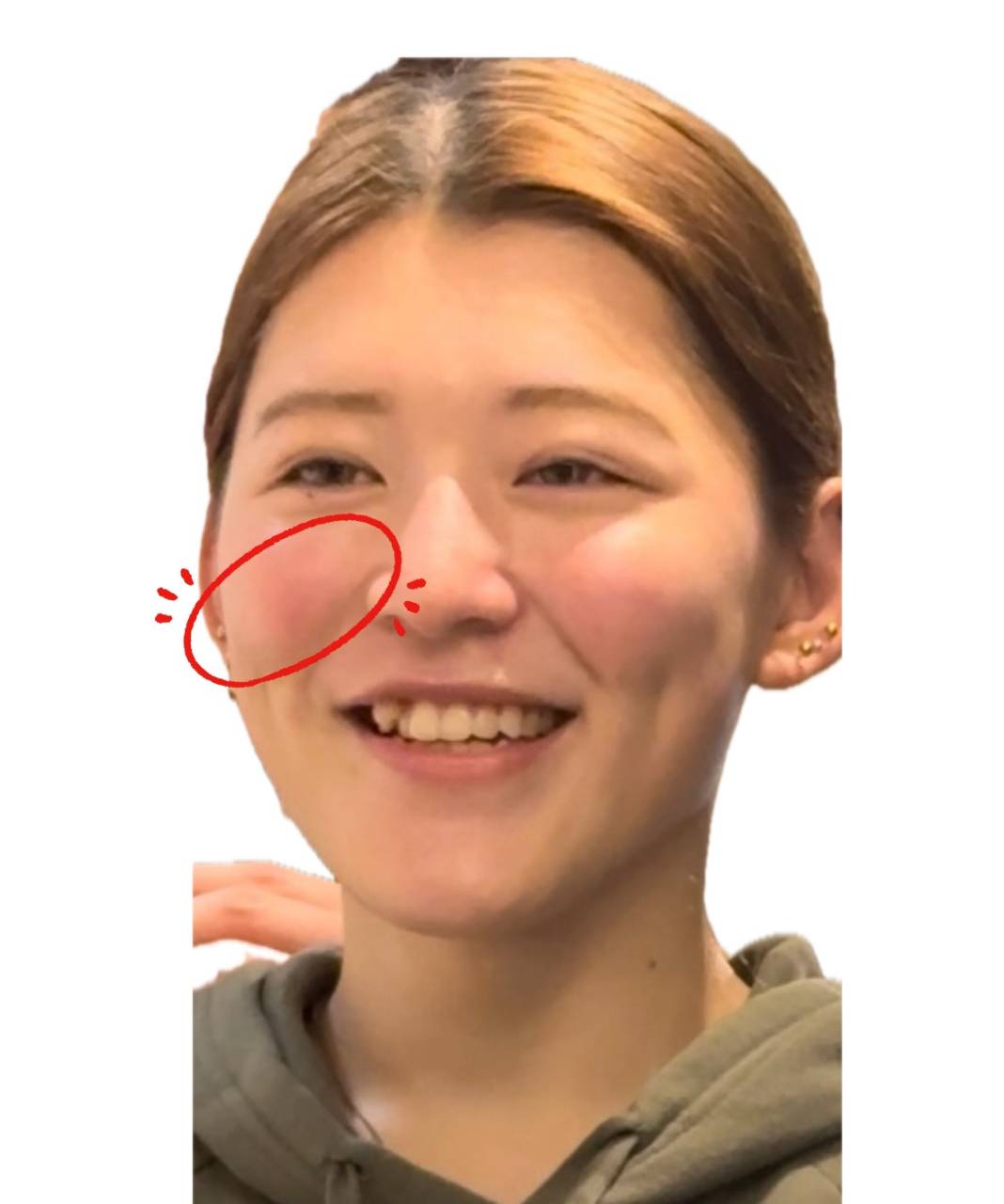 顔の下半分を、美しくしたい！ 筋トレ・マッサージ・アイテムを厳選美的.com