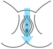 膀胱炎：日立保険サービス