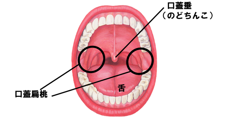 扁桃炎におすすめのレシピ食 Do