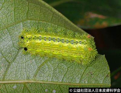 毛虫に刺された痕＝その後の写真素材105576149- PIXTA