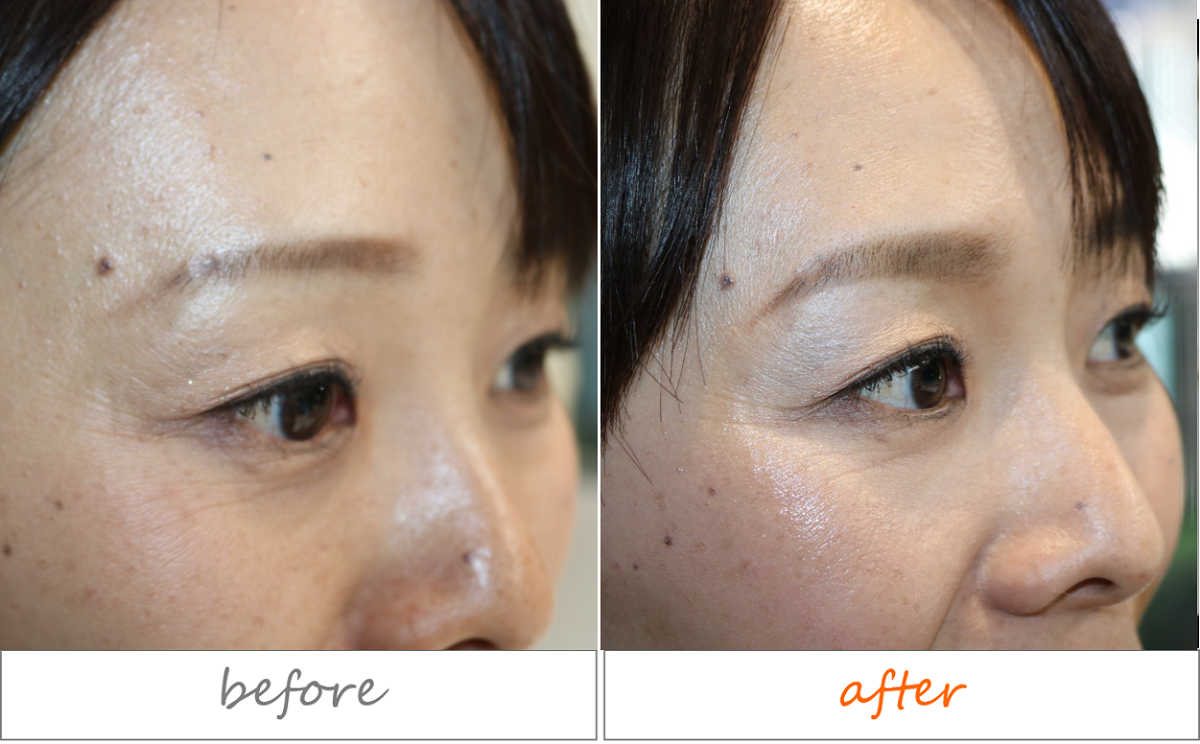 太眉ブームだけど 残念！急増する「眉盛り過ぎ女子」のNG4つ美的.com