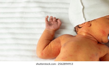 胆道閉鎖症みんなの医療ガイド兵庫医科大学病院