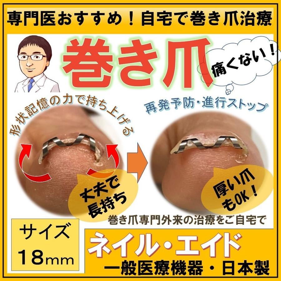 きちんと切って清潔に！爪の切り方のコツ