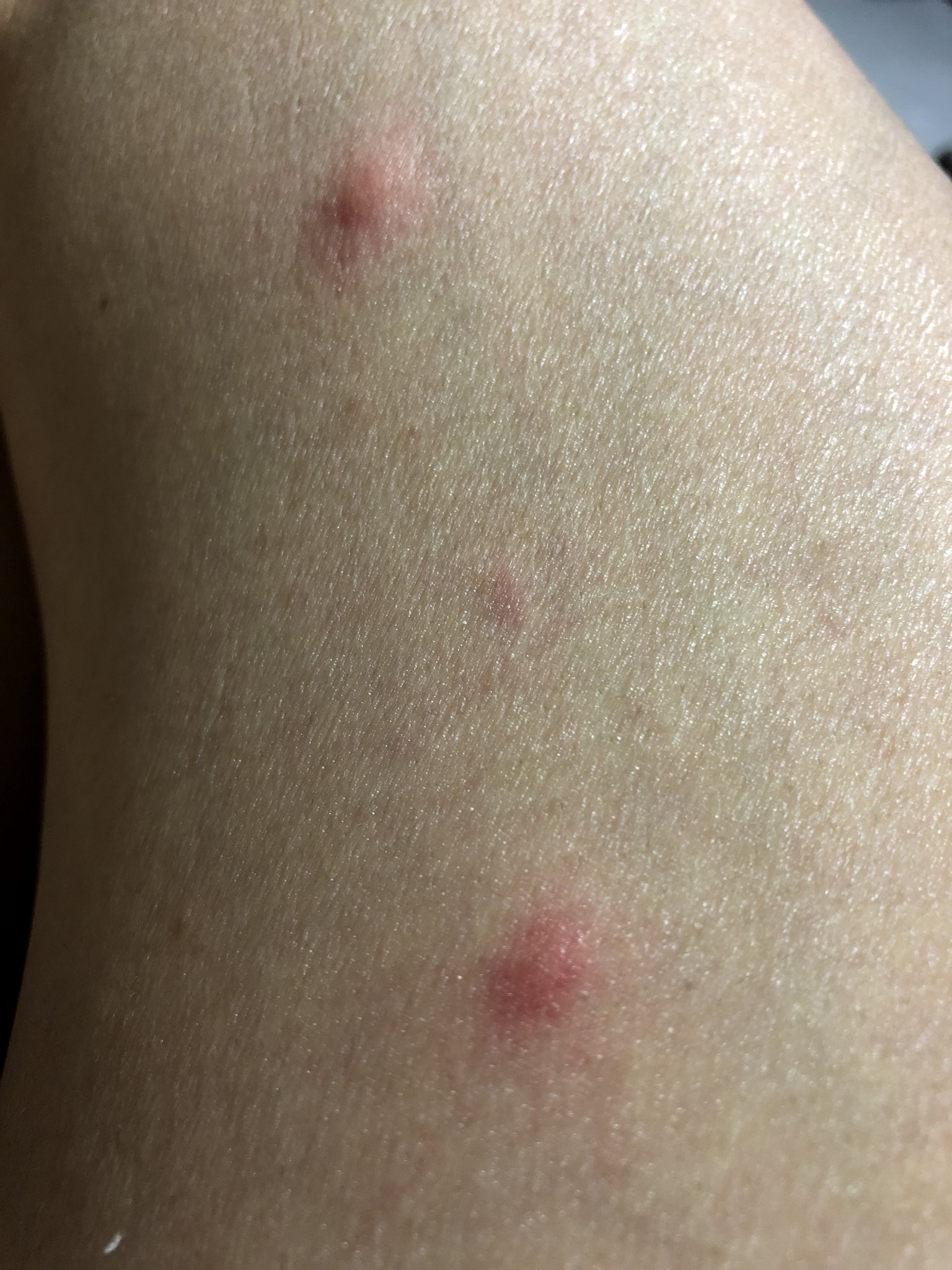 ノミの寄生猫獣医師監修 うちの子おうちの医療事典